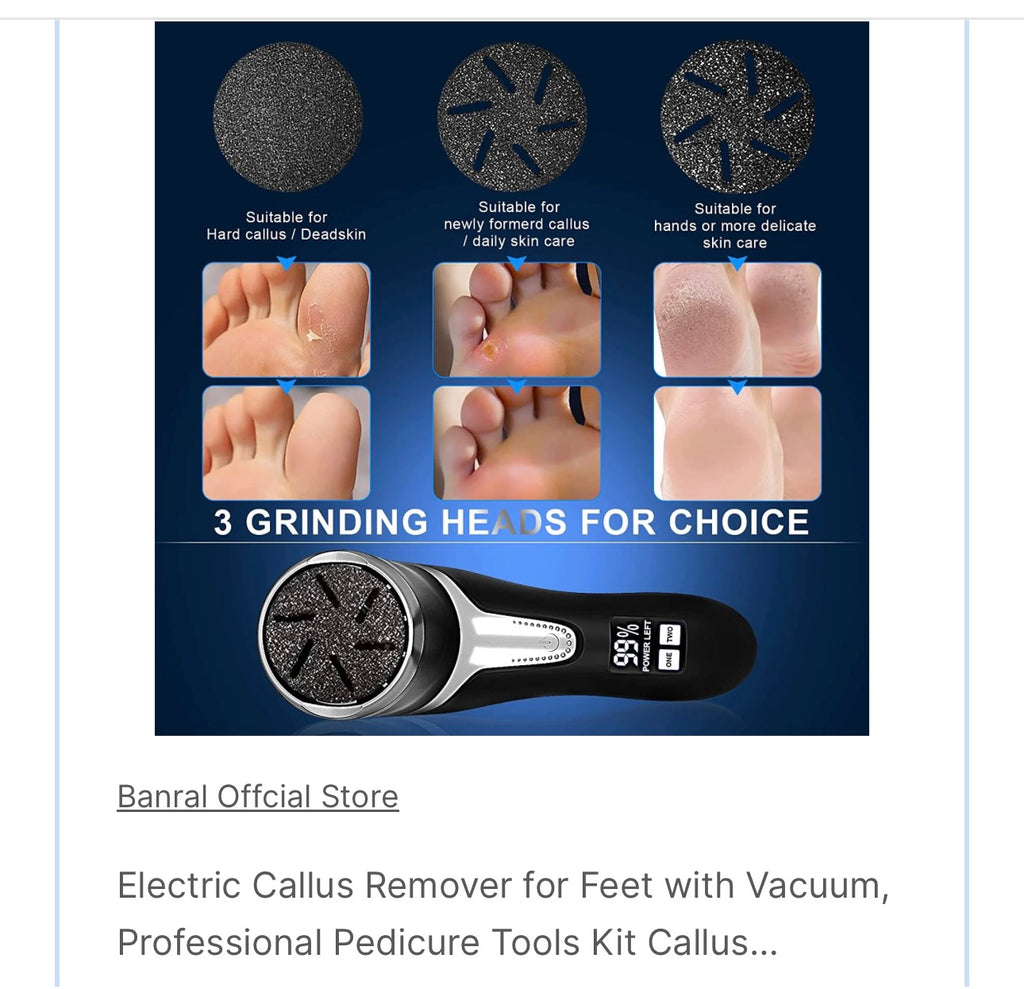 Electric Callus Remover for Feet
